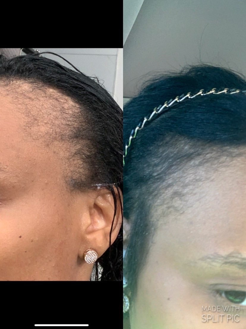Lanohands Natural Growth Oil